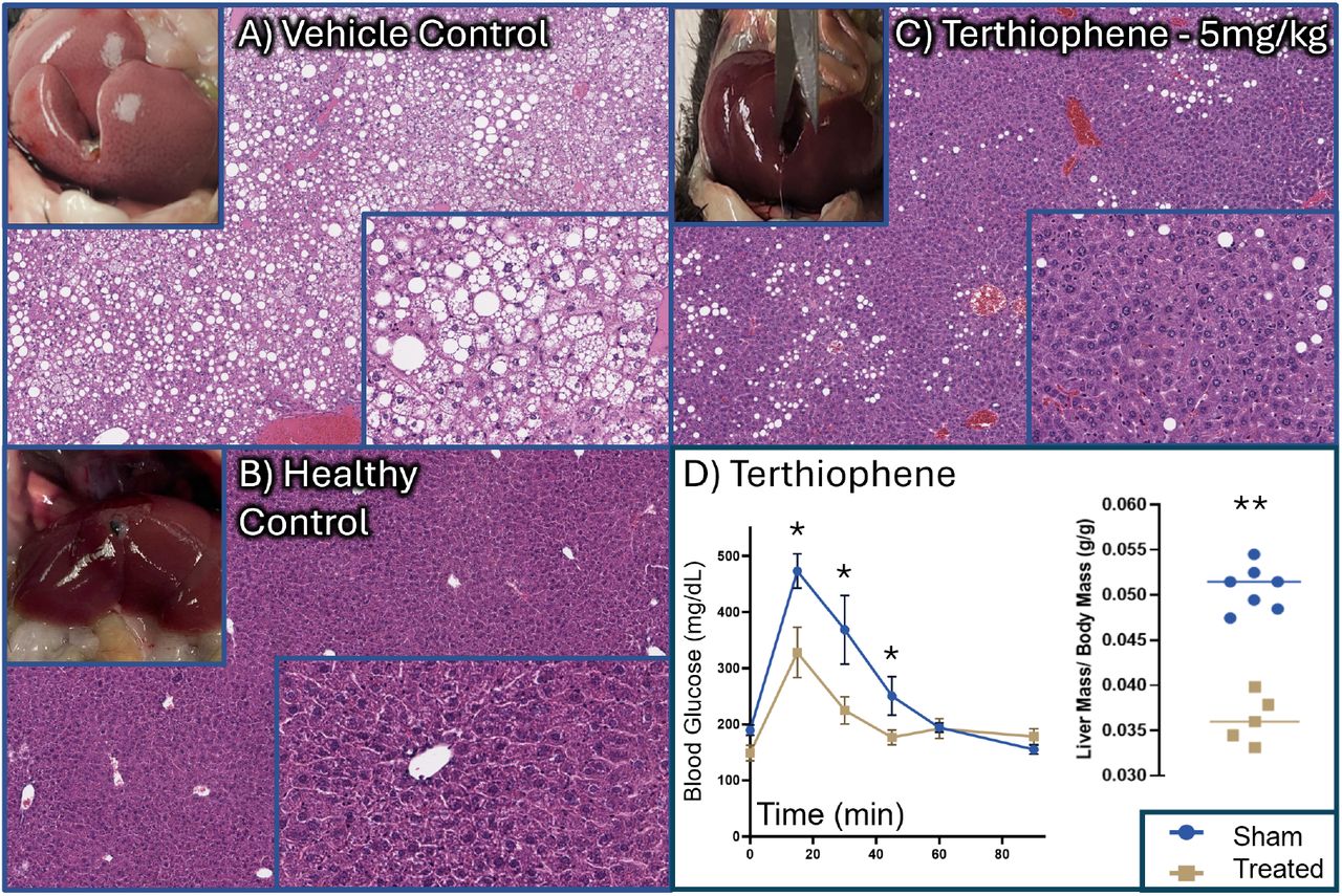 H&E-stained liver sections comparing vehicle control, healthy control, and α-terthienyl treated mice, with glucose tolerance and liver weight data